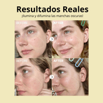 ANTES--11-