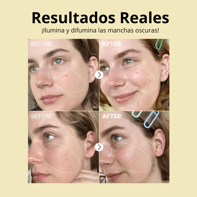 ANTES--11-