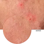 ly_provitamin_b5_and_centella_7_before-after_1750587930_1024x1024