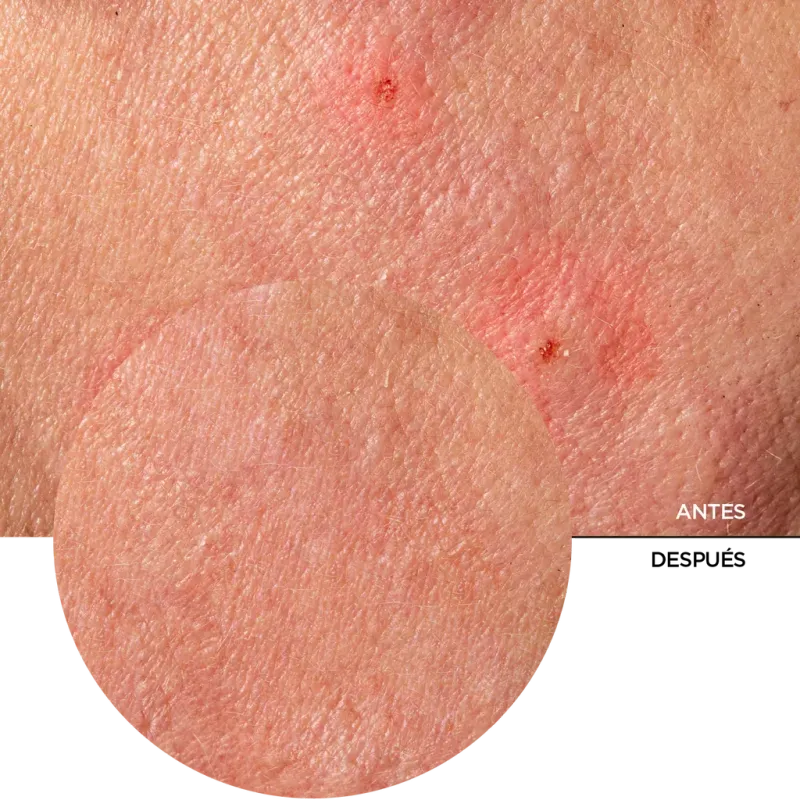 ly_provitamin_b5_and_centella_7_before-after_1750587930_1024x1024