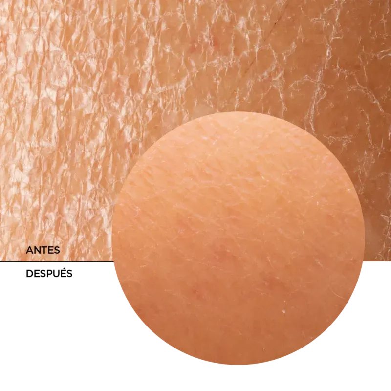 ly_skintreats_regenerating_filling_balm_7_before-after_1738257938_1024x1024