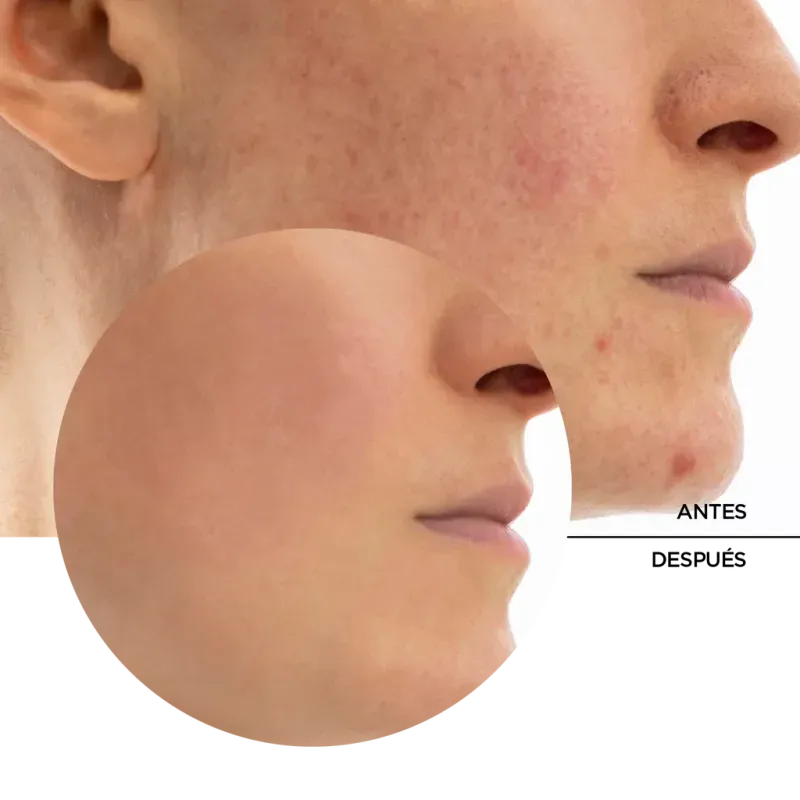 ly_skintreats_rebalancing_smoothing_gel_7_before-after_1738257839_1024x1024