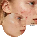ly_zitcare_bi-phase_multi_serum_7_before-after_1738258793_1024x1024