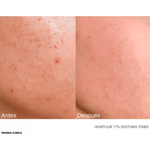 ANUA-HL-TONER-3.png