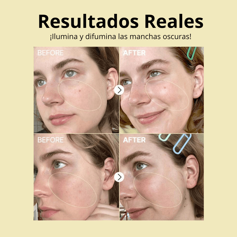 ANTES--11-